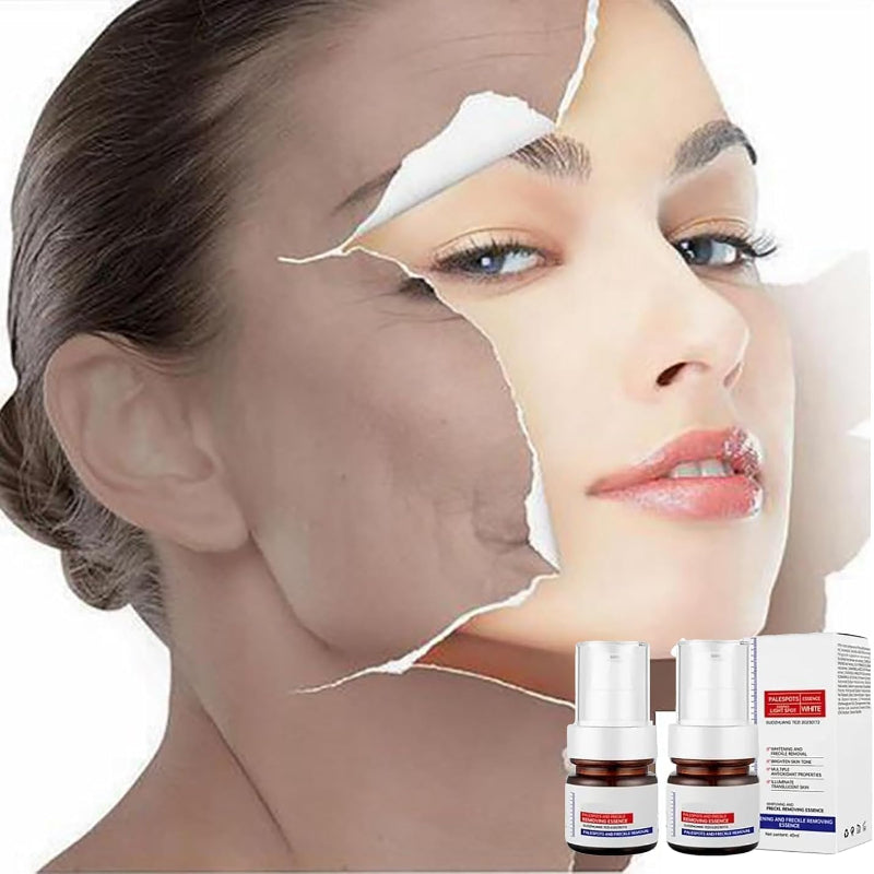 Pale Spot remover Essence