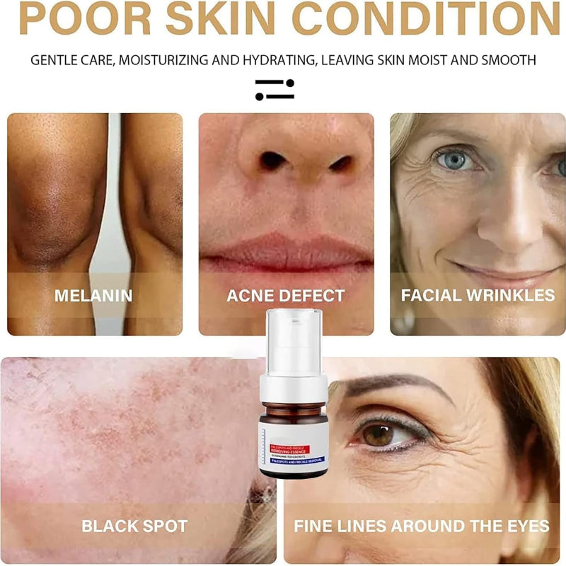 Pale Spot remover Essence