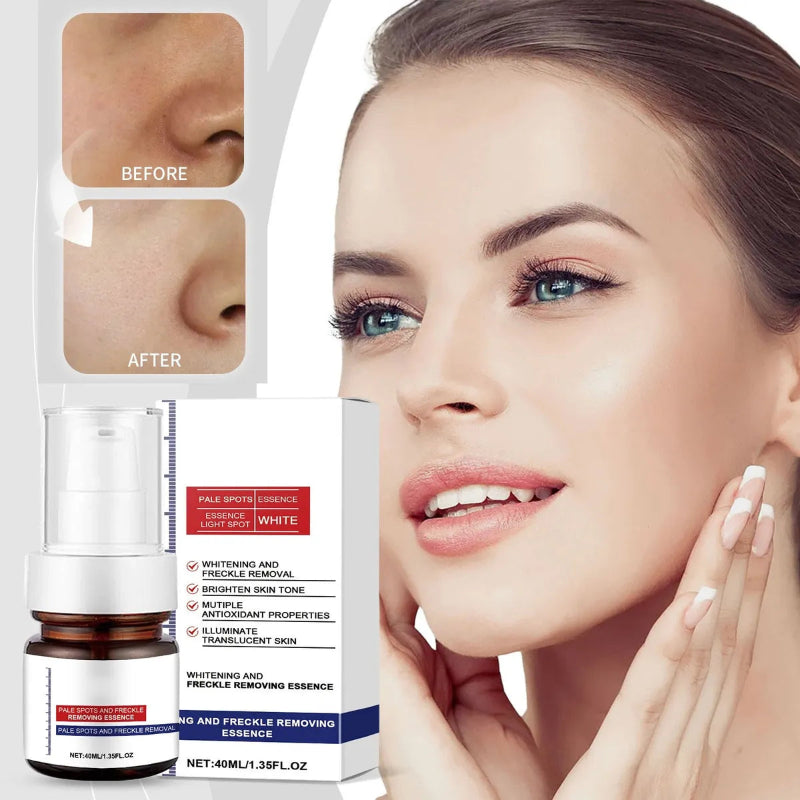 Pale Spot remover Essence