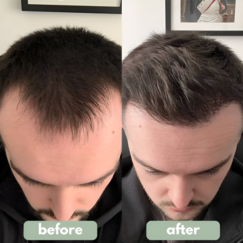 Roll-On Serum essential oils for hair growth