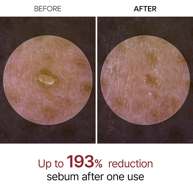 Dr. Melaxin Peel Shot skin treatment