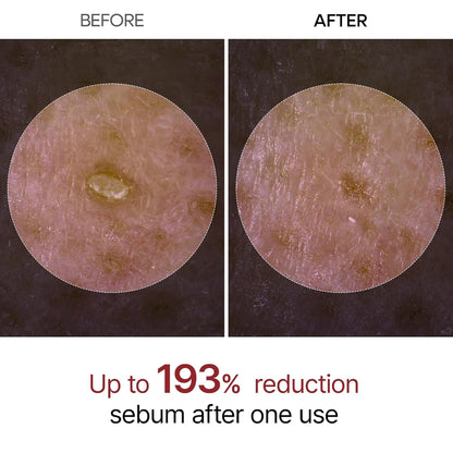 Dr. Melaxin Peel Shot skin treatment