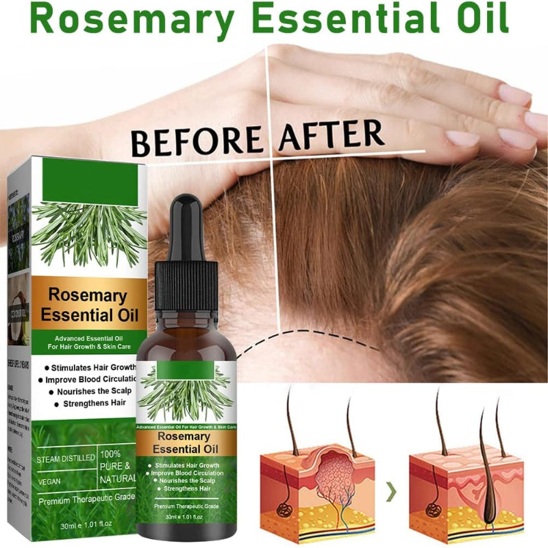 Essential Rosemary Oil for Hair