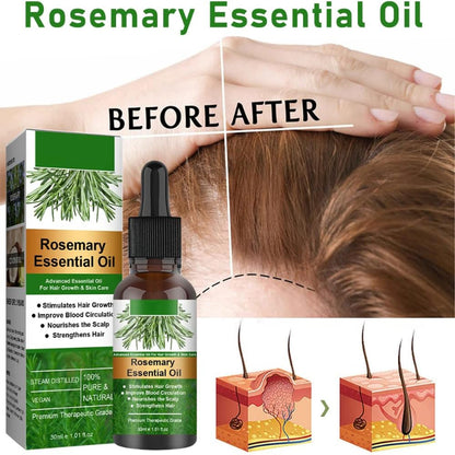 Essential Rosemary Oil for Hair