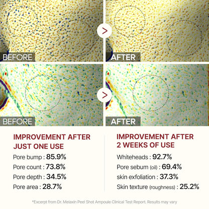 Dr. Melaxin Peel Shot skin treatment