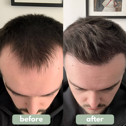 Roll-On Serum essential oils for hair growth