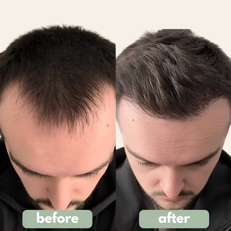 Rosemary Hair Serum Rolling Ball Essence Hair Root Strengthen Serum Scalp Care Essential Massage Roller Ball Nourishing